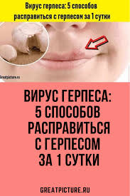 как вылечить герпес за 1 день в домашних условиях Virus Gerpesa 5 Sposobov Raspravitsya S Gerpesom Za 1 Sutki Lechenie Gerpesa Zdorove Sredstva Ot Gerpesa