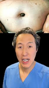 Check your belly button! 👀 #umbilicus #navelstone #donteatthat