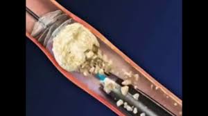 Pin On Medical Videos