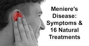 Meniere S Disease Symptoms 16 Natural Treatments David Avocado Wolfe