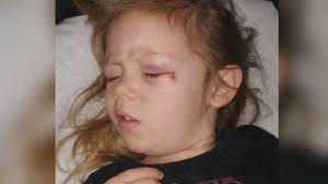 Mother: Daughters removed from charged Aurora foster parents' home in 2016