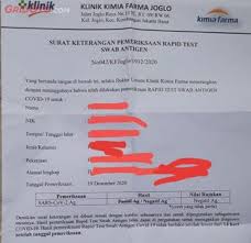 Coronavirus antibody tests could help identify donors of plasma from the ingezim® covid 19 crom total antibody detection lateral flow devices, or rapid tests, determine past exposure to the virus in just 10 minutes. Mau Berlibur Akhir Tahun Pemerintah Imbau Tes Rapid Antigen Ini Prosedur Dan Biayanya Gridoto Com