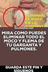 Pin On Flemas