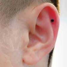 A new piercing is an open wound that can take several weeks to fully heal. Cartilage Piercing Infections Pierced