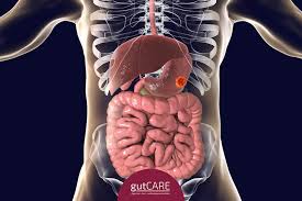 People with early stomach cancer don't usually have any symptoms. Identifying The Symptoms And Risk Factors Of Stomach Cancer