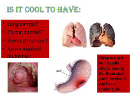 A specialist can arrange more tests to investigate whether you have lung cancer and, if you do, what type it is and how much it's spread. Tobacco Ppt Video Online Download