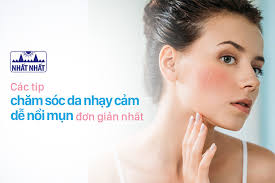 Những cách đơn giản nhất để chăm sóc da nhạy cảm dễ nổi mụn