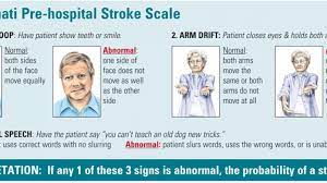 Arm drift (ask the patient to close their eyes and hold both arms out straight. Cincinnati Pre Hospital Stroke Scale Nurses Zone Source Of Resources For Nurses