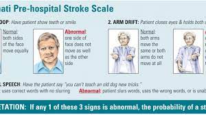 Arm drift (ask the patient to close their eyes and hold both arms out straight. Cincinnati Pre Hospital Stroke Scale Nurses Zone Source Of Resources For Nurses