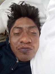 Los Angeles, California Unidentified male NamUs #UP12379 Date Body Found  January 26, 2014 Estimated Age Group Adult Estimated Age Range (Years)  30-45 Estimated Year of Death 2014 Estimated PMI -- Physical Description