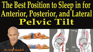 Pin On Anterior Pelvic Tilt