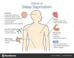 diagram effects sleep deprivation illustration disease