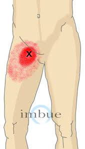 Pin On Body Moves To The Point