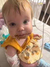 They're gonna do the scope around 130 tomorrow and then ENT is going to do  something to check