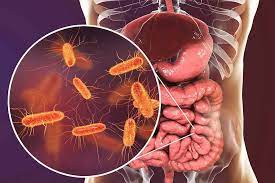 Remedios Caseros Para Reducir Parasitos Intestinales Mito O Realidad Mejor Con Salud