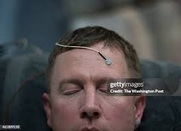 134 Traumatic Brain Injury Military Stock Photos, High-Res Pictures, and  Images