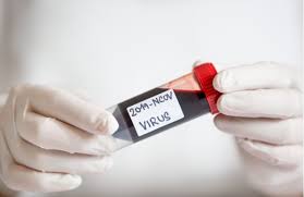 Sdělení výsledků garantujeme do 48 hodin. Testovani Zamestnancu Na Koronavirus Narizeni Zamestnavatele Finance Cz