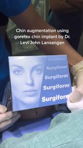 Chin Augmentation with Goretex Implant