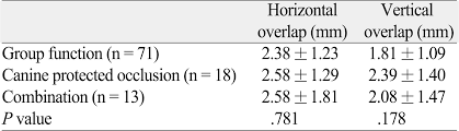 Of functional occlusion is defined as an arrangement of teeth which will provide the highest efficiency. Occlusal Scheme In A Group Of Thais Abstract Europe Pmc