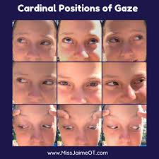 Even eyes have a Range of Motion! There are nine positions of gaze that  eyes should meet