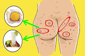 pin em cuidados saude
