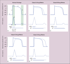 Image result for Antiarrhythmic