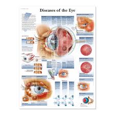 Diseases Of The Eye Poster Charts Diagrams Bernell