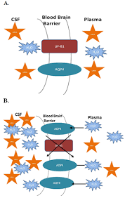 Dialysis Disequilibrium Syndrome
