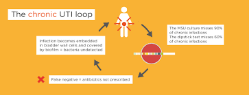 Image result for Recurrent Cystitis