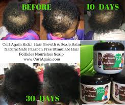 Pin On Curl Again African American Hair Growth Products Black Hair Growth Tips