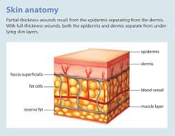 Image result for Skin Tear