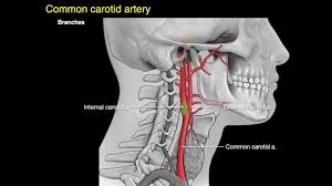 Learn more about causes, risk factors, screening and prevention. Arteries Of The Neck Youtube