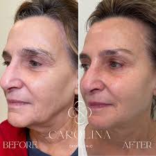Carolina Skin Clinic