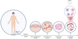 Image result for Envenomation