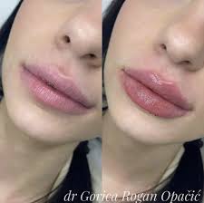 PRO VITA Medica Brčko