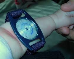 Image result for Sweat Chloride