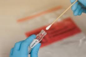 Covid 19 Viral Transport Medium Vtm For Diagnosis Clinisciences
