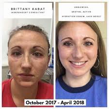 Wow, just look at these hydration results for my client today & her skin  looked amazing when she left 🥰