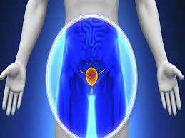 prostate me kya parhej karni chahiye? à¤ª à¤° à¤¸ à¤Ÿ à¤Ÿ à¤• à¤¸à¤° à¤¸ à¤ªà¤¹à¤² à¤¶à¤° à¤° à¤¦ à¤¤ à¤¹ 10 à¤š à¤¤ à¤µà¤¨ à¤œà¤° à¤° à¤•à¤° à¤ à¤¯ à¤® à¤¡ à¤•à¤² à¤Ÿ à¤¸ à¤Ÿ à¤Ÿà¤² à¤¸à¤•à¤¤ à¤¹ à¤® à¤¸ à¤¬à¤¤