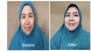 Efek samping dan bahaya moreskin clean and glow. Pengalaman Pakai Pelicin Wajah Oxyglow My Mind Untaian Kata Untuk Berbagi