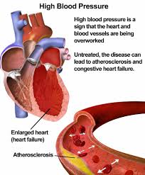 Blood Pressure Chart What Is The Normal Blood Pressure Range