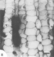 Image result for Allocassine laurifolia