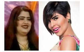 شمس أو كما تعرف بلقب شمس الكويتية واسمها الكامل شمس بندر نايف الأسلمي. Ù…Ù‚Ø·Ø¹ ÙÙŠØ¯ÙŠÙˆ Ù†Ø§Ø¯Ø± Ù„Ù€ Ø´Ù…Ø³ Ø§Ù„ÙƒÙˆÙŠØªÙŠØ© Ù‚Ø¨Ù„ Ø¹Ù…Ù„ÙŠØ§Øª Ø§Ù„ØªØ¬Ù…ÙŠÙ„ ÙŠØ«ÙŠØ± Ø§Ù„Ø¬Ø¯Ù„ Ù†ÙˆØ§Ø¹Ù…