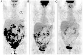 Fizz Ct Scan Ct Scan Machine