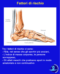 Quali sono i fattori di rischio? Rottura Del Tendine D Achille I Sintomi E La Riabilitazione