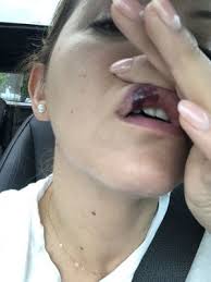 At kevitch, chung, & jan aesthetic surgery associates, we strive to help you get . Kevitch Chung Jan Aesthetic Surgery Associates 250 Cetronia Rd Ste 301 Allentown Pa Doctors Mapquest