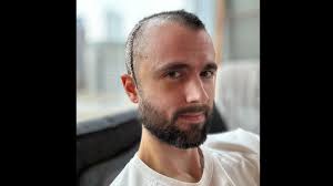 Fundraiser by Will Gerhardt : Helping Will cover expenses from head injury