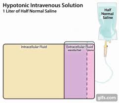 breaking down iv fluids the 4 most commonly used types