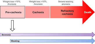 Image result for Cachexia in Cancer