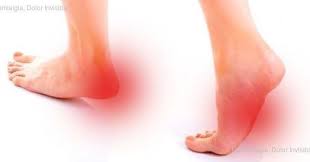 Otra Condicion Dolorosa Que Tambien Ocurre Junto A La Fibromialgia Que Es Https Www Fibromialgiadolori Fibromialgia Dolor En El Talon Dolor De Pies